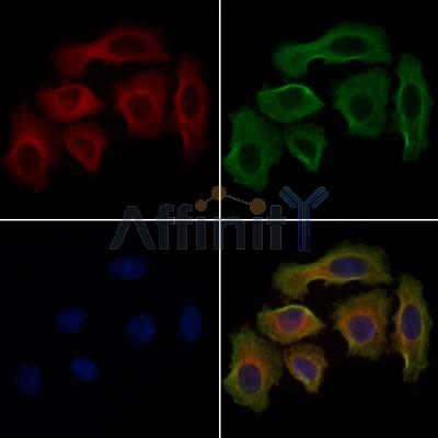 CHAC1 Antibody - DF9353 staining Hela cells by IF/ICC.