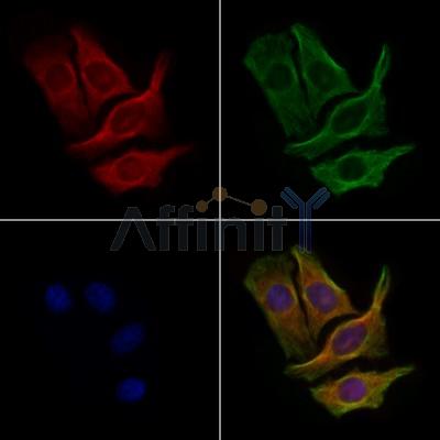 CEP110 Antibody - DF9360 staining Hela cells by IF/ICC.