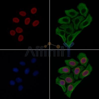 NCAPD3 Antibody - DF9413 staining Hela cells by IF/ICC.
