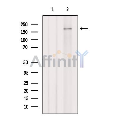 NCAPD3 Antibody - Western blot analysis of extracts from B16F10 cells, using NCAPD3 Antibody.