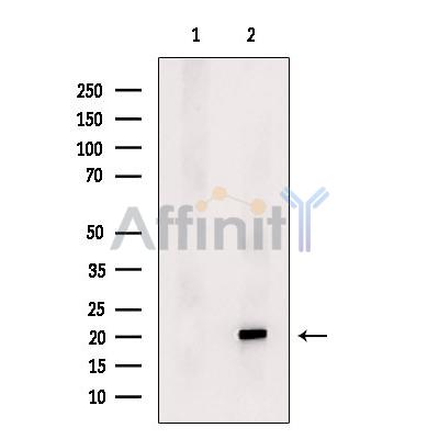 DHRS10 Antibody - Western blot analysis of extracts from B16F10 cells, using DHRS10 Antibody.