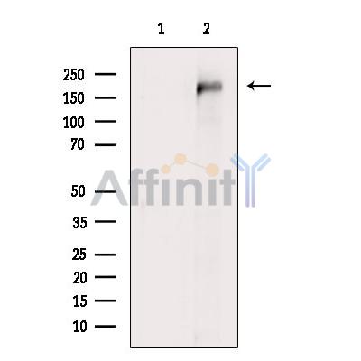 UBR2 Antibody - Western blot analysis of extracts from Hybridoma cells, using UBR2 Antibody.