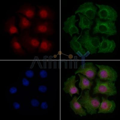 KHSRP Antibody - DF9514 staining HepG2 cells by IF/ICC.