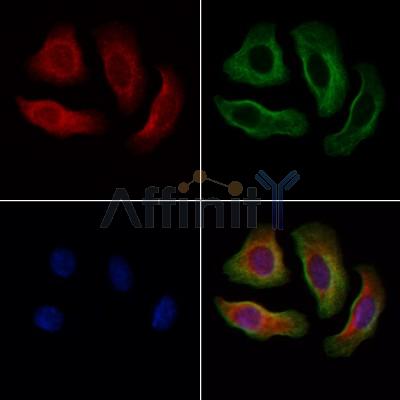 FBLN1 Antibody - DF9516 staining Hela cells by IF/ICC.