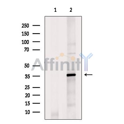 HOXC12 Antibody - Western blot analysis of extracts from DU145 cells, using HOXC12 Antibody.