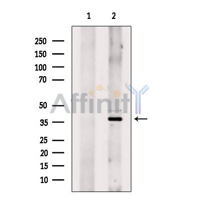 HOXD9 Antibody - Western blot analysis of extracts from 293, using HOXD9 Antibody.