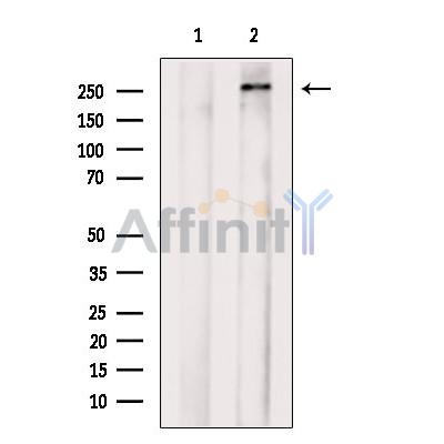 MYO7A Antibody - Western blot analysis of extracts from Mouse  kidney, using MYO7A Antibody.