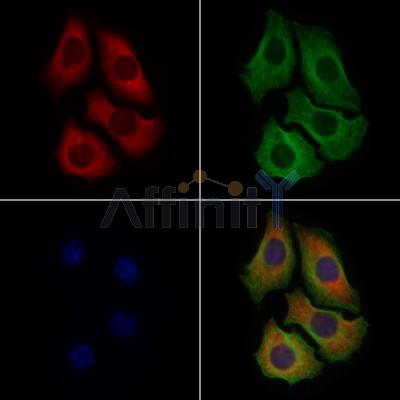 MYO16 Antibody - DF9656 staining Hela cells by IF/ICC.