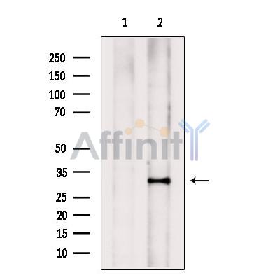 PHOX2B Antibody - Western blot analysis of extracts from various samples, using PHOX2B Antibody.