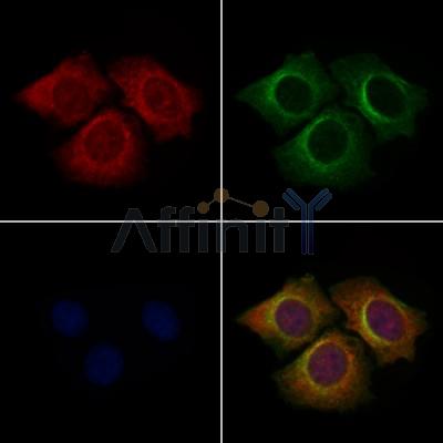 PPP1R3D Antibody - DF9780 staining Hela cells by IF/ICC.