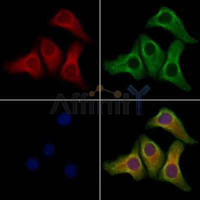 PPP1R2P3 Antibody - DF9782 staining Hela cells by IF/ICC.