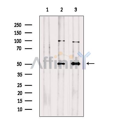 SERPINA10 Antibody - Western blot analysis of extracts from various samples, using SERPINA10 Antibody.