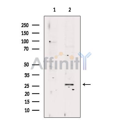 RAB23 Antibody - Western blot analysis of extracts from MDA-MB-231 cells, using RAB23 Antibody.