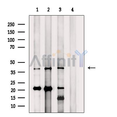 RAB40C Antibody - Western blot analysis of extracts from various samples, using RAB40C Antibody.