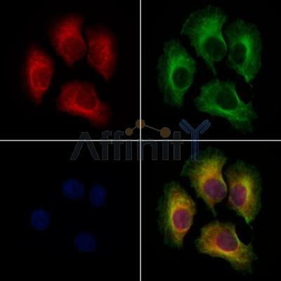 TRAPPC1 Antibody - DF9964 staining Hela cells by IF/ICC.