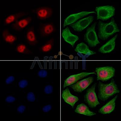 TCEAL5 Antibody - DF9968 staining Hela cells by IF/ICC.