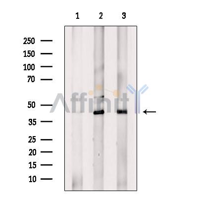 USP12 Antibody - Western blot analysis of extracts from various samples, using USP12 Antibody.