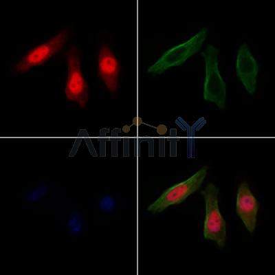 CCDC99 Antibody - AF0628 staining Hela cells by IF/ICC.