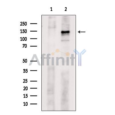 c-Kit Antibody - Western blot analysis of extracts from heat-shock treated NIH-3T3 cells, using c-Kit Antibody.