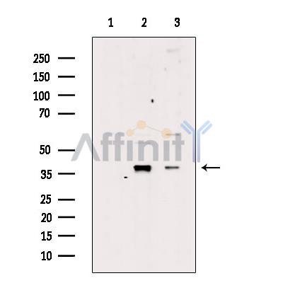 Nucleophosmin Antibody - Western blot analysis of extracts from various samples, using NPM Antibody.