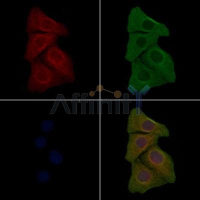 Phospho-EGFR (Tyr1048)[Tyr1172] Antibody - AF3047 staining HepG2 cells(4h of LPS treatment) by IF/ICC.