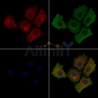 Phospho-EGFR (Tyr1173)[Tyr1197] Antibody - AF3048 staining HepG2 cells(4h of LPS treatment) by IF/ICC.