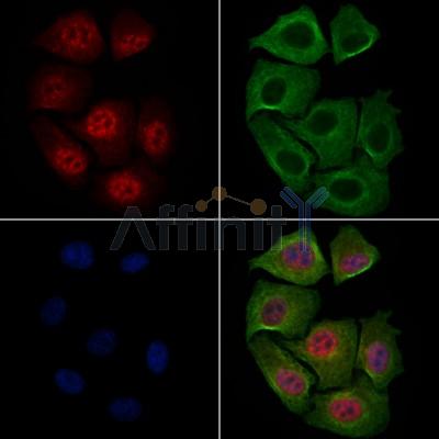 Phospho-c-Myc (Thr58) Antibody - AF3055 staining HepG2 cells(4h of LPS treatment) by IF/ICC.