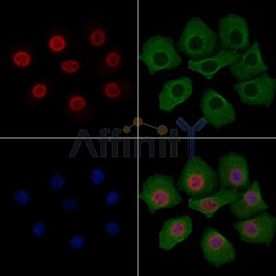 Phospho-Estrogen Receptor alpha (Ser106) Antibody - AF3060 staining HepG2 cells(4h of LPS treatment) by IF/ICC.