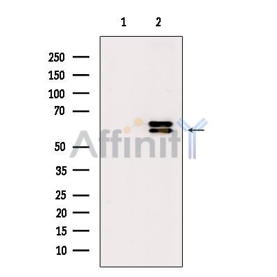 Phospho-Lck (Tyr393)[Tyr394] Antibody - Western blot analysis of extracts from UV treated RAW264.