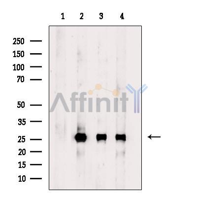 Phospho-eIF4E (Ser209) Antibody - Western blot analysis of extracts from various samples, using Phospho-eIF4E (Ser209) Antibody.