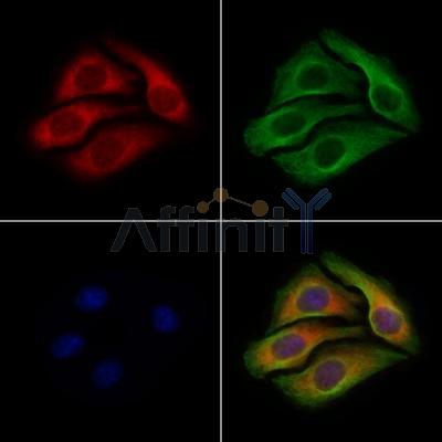 Phospho-eIF4E (Ser209) Antibody - AF3110 staining Hela cells(4h of LPS treatment) by IF/ICC.