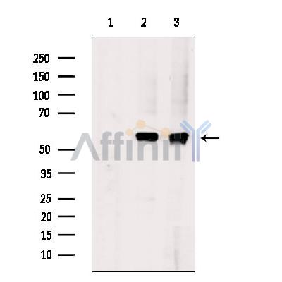 Phospho-Src (Tyr527)[Tyr530] Antibody - Western blot analysis of extracts from serum starvation treated MCF7 cells/serum starvation treated A2780 cells, using Phospho-Src (Tyr530) Antibody.