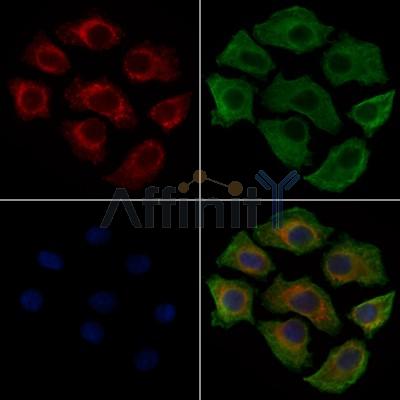 Phospho-Ezrin (Tyr353)[Tyr354] Antibody - AF3173 staining HepG2 cells(4h of LPS treatment) by IF/ICC.