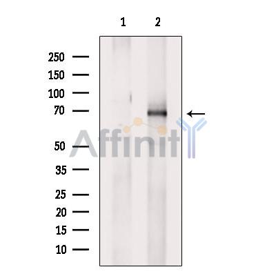 Phospho-Ezrin (Tyr353)[Tyr354] Antibody - Western blot analysis of extracts from UV treated NIH-3T3 cells, using Phospho-Ezrin (Tyr353) Antibody.