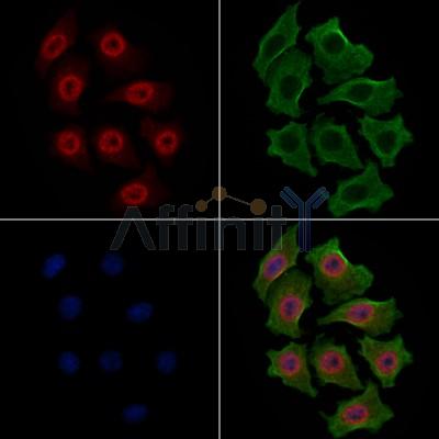 Phospho-p70 S6 Kinase (Ser424)[Ser447] Antibody - AF3230 staining HepG2 cells(4h of LPS treatment) by IF/ICC.