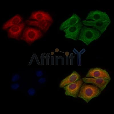 Phospho-CXCR2 (Ser347) Antibody - AF3238 staining Hela cells(4h of LPS treatment) by IF/ICC.