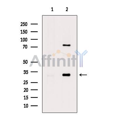 Phospho-MARCKS (Ser159) Antibody - Western blot analysis of extracts from LPS treated RAW264.
