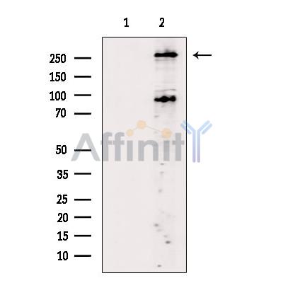 Phospho-mTOR (Ser2448) Antibody - Western blot analysis of extracts from LPS treated HepG2 cells, using Phospho-mTOR (Ser2448) Antibody.