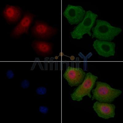 Phospho-FOXO1A (Ser319) Antibody - AF3418 staining HepG2 cells(4h of LPS treatment) by IF/ICC.
