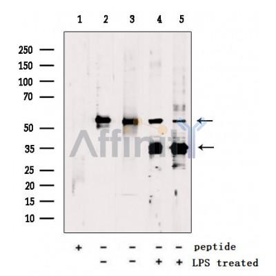 GSDMD Antibody - Western blot analysis of extracts from various samples, using GSDMD Antibody.