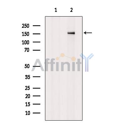 Phospho-MRIP (Thr542) Antibody - Western blot analysis of extracts from H2O2 treated MDA-MB-231 cells, using Phospho-MRIP(Thr542) Antibody.