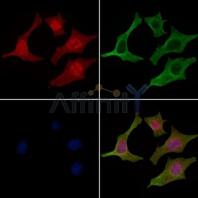 Phospho-GRAP2 (Thr262) Antibody - AF4322 staining HepG2 cells(4h of LPS treatment) by IF/ICC.