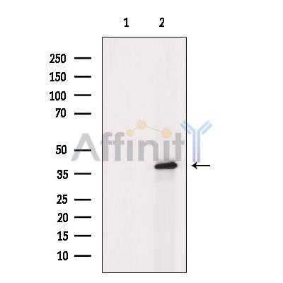 Phospho-GRAP2 (Thr262) Antibody - Western blot analysis of extracts from H2O2 treated MDA-MB-231 cells, using Phospho-GRAP2(Thr262) Antibody.