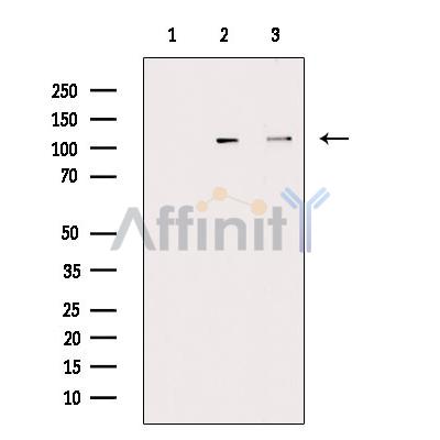 Phospho-NEDD4 (Ser670) Antibody - Western blot analysis of extracts from various samples, using Phospho-NEDD4(Ser670) Antibody.