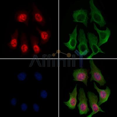 Phospho-BRG1 (Ser610) Antibody - AF4338 staining HepG2 cells(4h of LPS treatment) by IF/ICC.