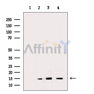 Acetyl-Histone H2A (Lys5) Antibody - Western blot analysis of extracts from various samples, using Acetyl-Histone H2A (Lys5) Antibody.