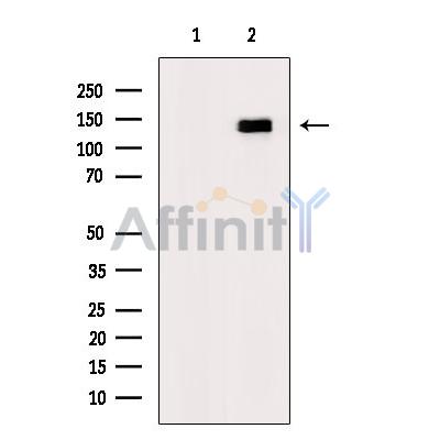 Phospho-EPHA4 (Tyr602) Antibody - Western blot analysis of extracts from LPS treated C6 cells, using Phospho-EPHA4(Tyr602) Antibody.