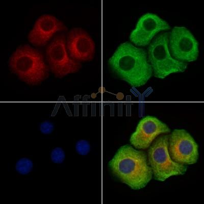 Phospho-LAT (Tyr191)[Tyr220] Antibody - AF4380 staining Hela cells(4h of LPS treatment) by IF/ICC.
