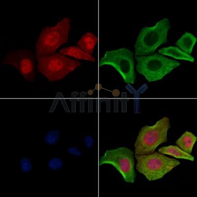 Phospho-Catenin 1 (Ser320) Antibody - AF4384 staining Hela cells(4h of LPS treatment) by IF/ICC.