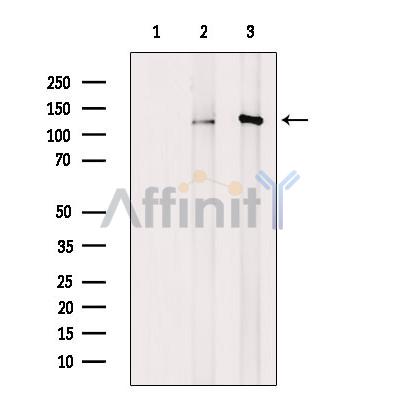 Phospho-Eg5 (Thr926) Antibody - Western blot analysis of extracts from various samples, using Phospho-KIF11/Eg5 (Thr926) Antibody.